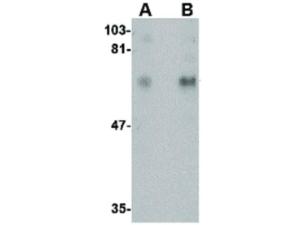 Anti-CPEB1 Rabbit polyclonal antibody