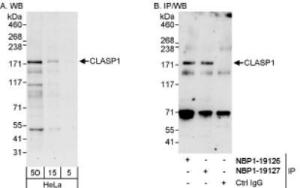 Apc10 Overexpression Lysate (Adult Normal), Novus Biologicals (NBL1-07512)