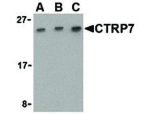 Anti-C1QTNF7 Rabbit polyclonal antibody