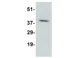 Anti-ACKR1 Rabbit polyclonal antibody