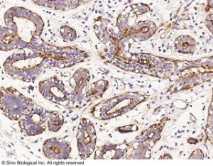 Anti-MUC1 Mouse Monoclonal Antibody