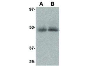 Anti-CXCR4 Rabbit polyclonal antibody