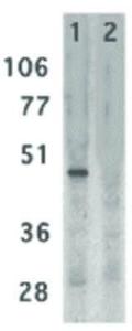 Anti-CD209 Rabbit polyclonal antibody