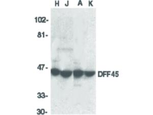 Anti-DFFA Rabbit polyclonal antibody