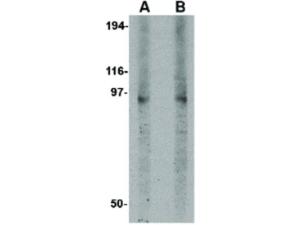 Anti-DISC1 Rabbit polyclonal antibody