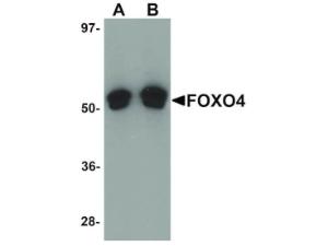 Anti-FOXO4 Rabbit polyclonal antibody