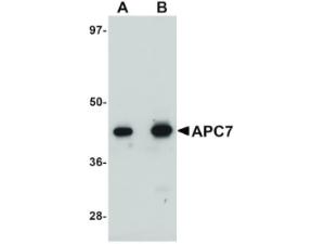 Anti-ANAPC7 Rabbit polyclonal antibody