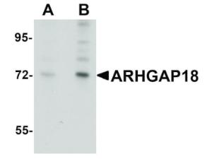 Anti-ARHGAP18 Rabbit polyclonal antibody