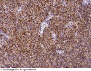 Anti-MUC1 Rabbit Polyclonal Antibody