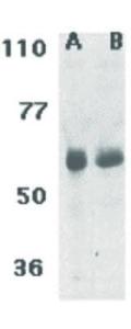 Anti-TRAF3IP2 Rabbit polyclonal antibody