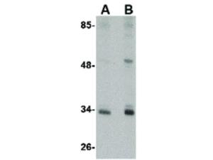 Anti-CUEDC2 Rabbit polyclonal antibody