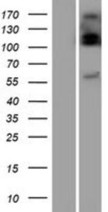 UGT2B10 Lysate (Adult Normal), Novus Biologicals (NBP2-08443)