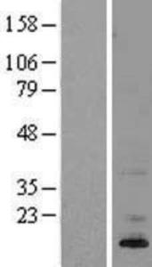 ASIP Overexpression Lysate (Adult Normal), Novus Biologicals (NBL1-07766)