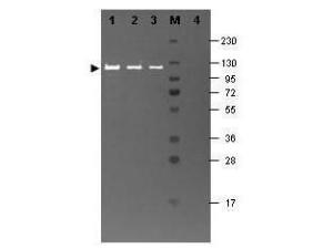 Anti-GLB1 Rabbit polyclonal antibody (FITC (Fluorescein Isothiocyanate))
