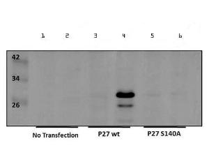 Anti-CDKN1B Rabbit polyclonal antibody