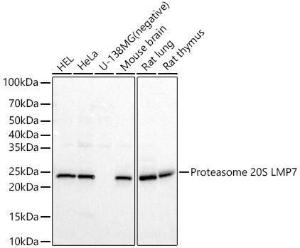 Western blot analysis of various lysates, using Anti-Proteasome 20S LMP7 Antibody (A309447) at 1:600 dilution