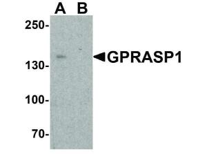 Anti-GPRASP1 Rabbit polyclonal antibody
