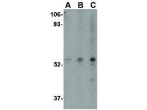 Anti-SP110 Rabbit polyclonal antibody