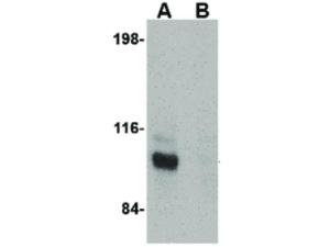 Anti-JPH3 Rabbit polyclonal antibody