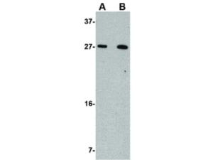 Anti-KLRA1 Rabbit polyclonal antibody