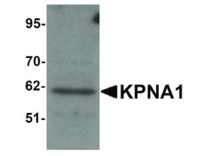 Anti-KPNA1 Rabbit polyclonal antibody
