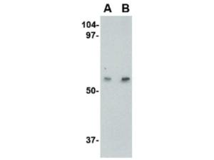 Anti-LGI4 Rabbit polyclonal antibody