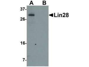 Anti-LIN28A Mouse monoclonal antibody [Clone: [1G9H9]]