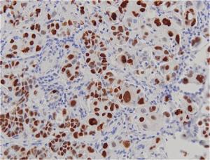 This antibody is suitable for all IHC