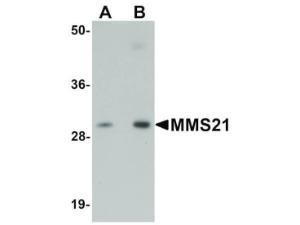 Anti-NSMCE2 Rabbit polyclonal antibody
