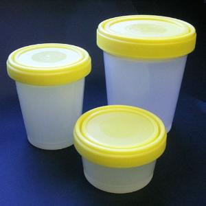 Histology Containers, Globe Scientific