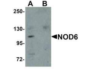 Anti-NLRP9 Rabbit polyclonal antibody