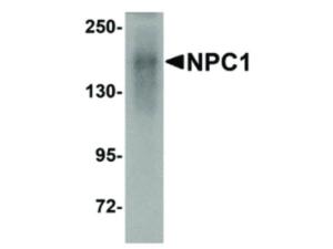 Anti-NPC1 Rabbit polyclonal antibody