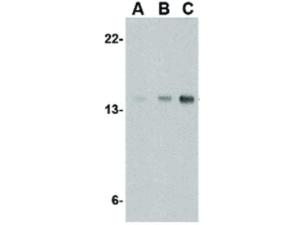 Anti-STMN1 Rabbit polyclonal antibody