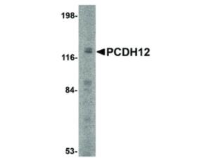 Anti-PCDH12 Rabbit polyclonal antibody