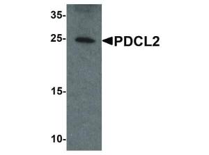 Anti-PDCL2 Rabbit polyclonal antibody