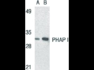 Anti-ANP32A Rabbit polyclonal antibody