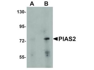 Anti-PIAS2 Rabbit polyclonal antibody