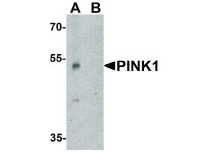 Anti-PINK1 Rabbit polyclonal antibody