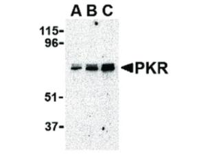 Anti-EIF2AK2 Rabbit polyclonal antibody