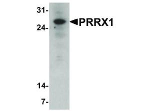 Anti-PRRX1 Rabbit polyclonal antibody