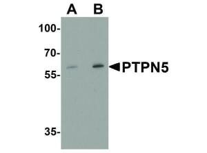 Anti-PTPN5 Rabbit polyclonal antibody