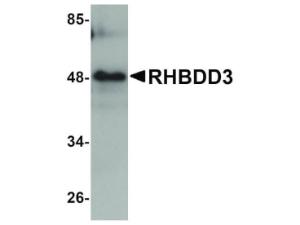 Anti-RHBDD3 Rabbit polyclonal antibody
