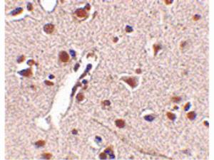 Anti-MEX3A Rabbit polyclonal antibody