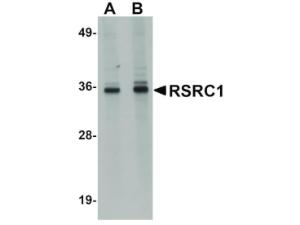 Anti-RSRC1 Rabbit polyclonal antibody
