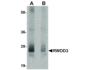 Anti-RWDD3 Rabbit polyclonal antibody