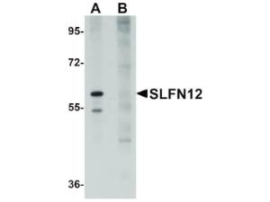 Anti-SLFN12 Rabbit polyclonal antibody