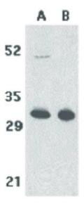 Anti-TNFRSF13B Rabbit polyclonal antibody