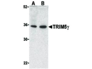 Anti-TRIM5 Rabbit polyclonal antibody