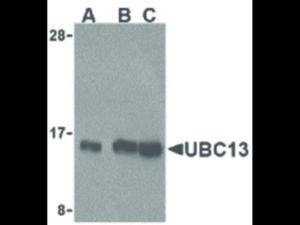 Anti-UBE2N Rabbit polyclonal antibody