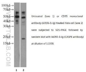 Anti-CASP8 Mouse Monoclonal Antibody [clone: 2B9H8]